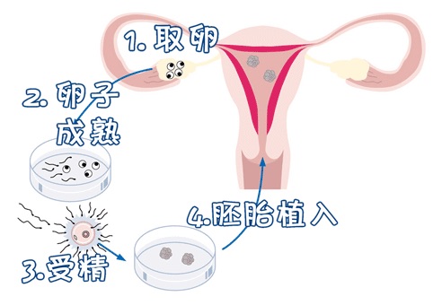 助孕包生男孩服务